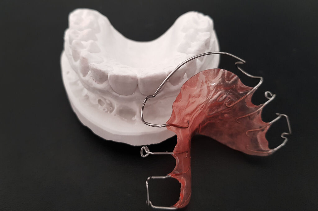 dentALEX Eigenschink Leistungen Kieferorthopaedie